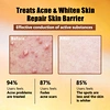 micro needling serum